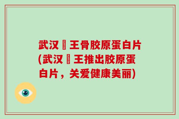 武汉榾王骨胶原蛋白片(武汉榾王推出胶原蛋白片,关爱健康美丽) 武汉榾王骨胶原蛋白片(武汉榾王推出胶原蛋白片,关爱健康美丽)