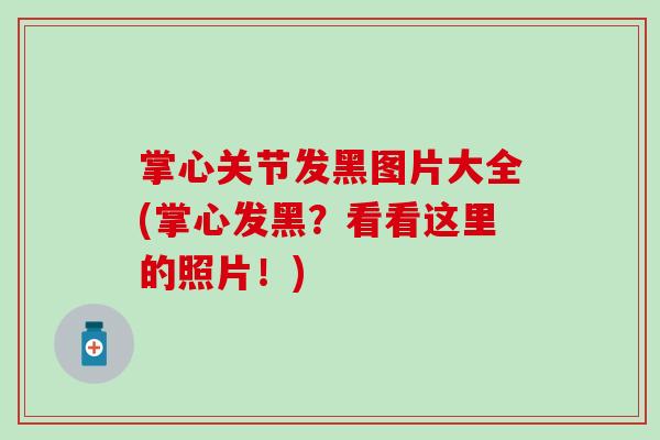掌心关节发黑图片大全(掌心发黑?看看这里的照片!) 掌心关节发黑图片大全(掌心发黑?看看这里的照片!)