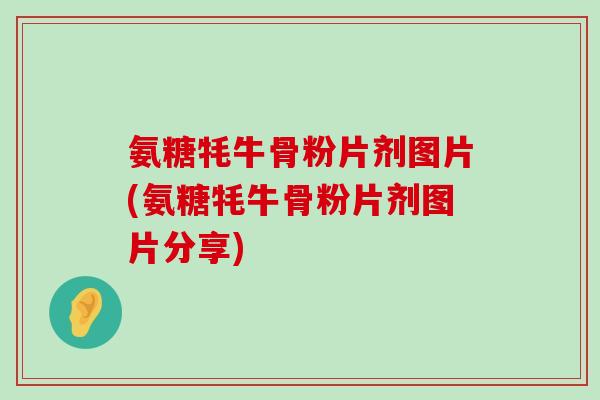 氨糖牦牛骨粉片剂图片(氨糖牦牛骨粉片剂图片分享) 氨糖牦牛骨粉片剂图片(氨糖牦牛骨粉片剂图片分享)