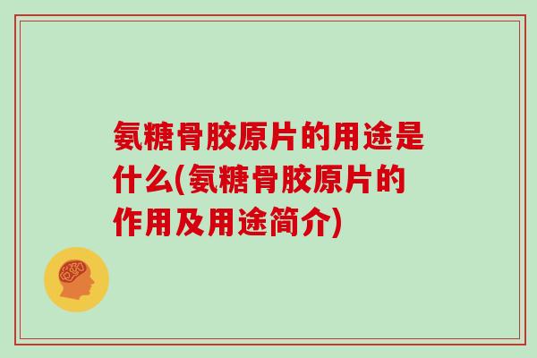 氨糖骨胶原片的用途是什么(氨糖骨胶原片的作用及用途简介) 氨糖骨胶原片的用途是什么(氨糖骨胶原片的作用及用途简介)