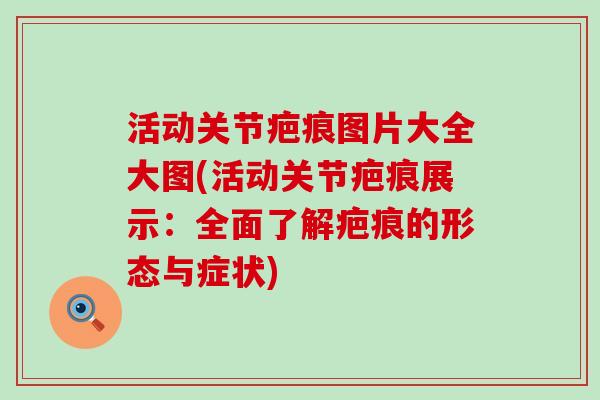 活动关节疤痕图片大全大图(活动关节疤痕展示:全面了解疤痕的形态与症状) 活动关节疤痕图片大全大图(活动关节疤痕展示:全面了解疤痕的形态与症状)