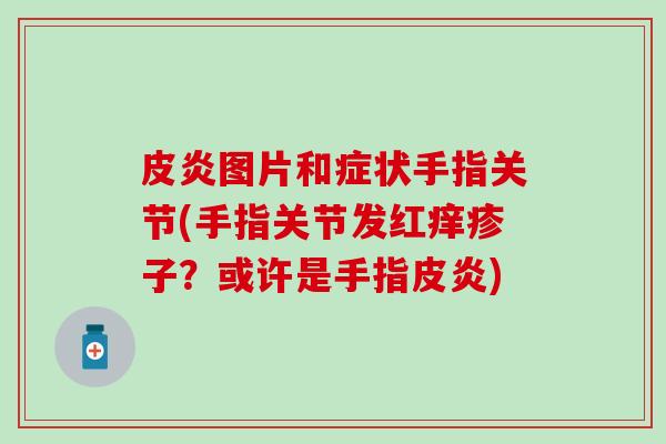 皮炎图片和症状手指关节(手指关节发红痒疹子?或许是手指皮炎) 皮炎图片和症状手指关节(手指关节发红痒疹子?或许是手指皮炎)