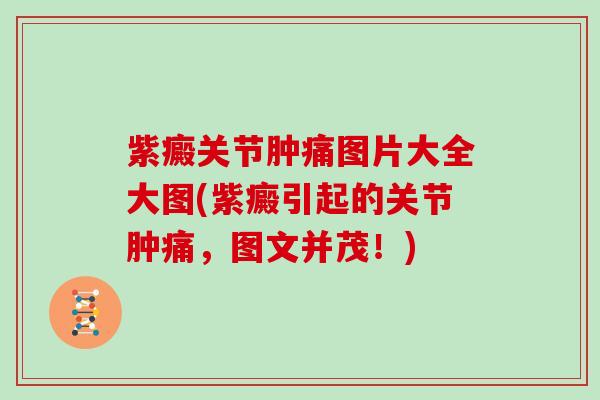 紫癜关节肿痛图片大全大图(紫癜引起的关节肿痛,图文并茂!) 紫癜关节肿痛图片大全大图(紫癜引起的关节肿痛,图文并茂!)