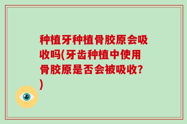 种植牙种植骨胶原会吸收吗(牙齿种植中使用骨胶原是否会被吸收?) 种植牙种植骨胶原会吸收吗(牙齿种植中使用骨胶原是否会被吸收?)