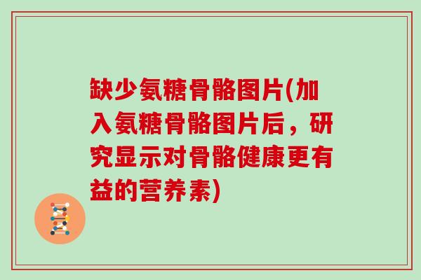 缺少氨糖骨骼图片(加入氨糖骨骼图片后,研究显示对骨骼健康更有益的营养素) 缺少氨糖骨骼图片(加入氨糖骨骼图片后,研究显示对骨骼健康更有益的营养素)