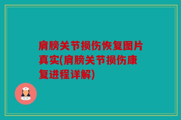肩膀关节损伤恢复图片真实(肩膀关节损伤康复进程详解) 肩膀关节损伤恢复图片真实(肩膀关节损伤康复进程详解)
