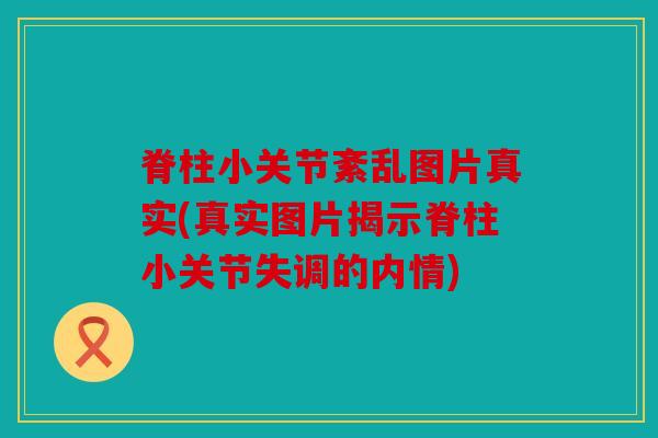 脊柱小关节紊乱图片真实(真实图片揭示脊柱小关节失调的内情)