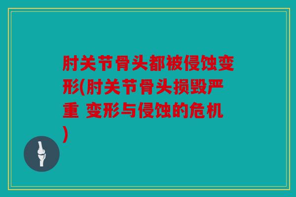 肘关节骨头都被侵蚀变形(肘关节骨头损毁严重 变形与侵蚀的危机)