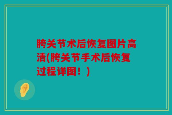 胯关节术后恢复图片高清(胯关节手术后恢复过程详图!) 胯关节术后恢复图片高清(胯关节手术后恢复过程详图!)