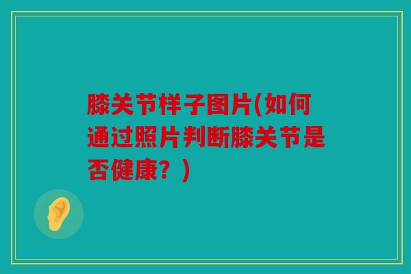 膝关节样子图片(如何通过照片判断膝关节是否健康?) 膝关节样子图片(如何通过照片判断膝关节是否健康?)