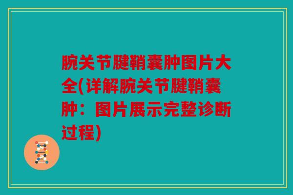 腕关节腱鞘囊肿图片大全(详解腕关节腱鞘囊肿：图片展示完整诊断过程)