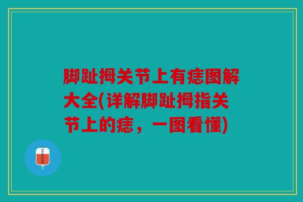 脚趾拇关节上有痣图解大全(详解脚趾拇指关节上的痣，一图看懂)