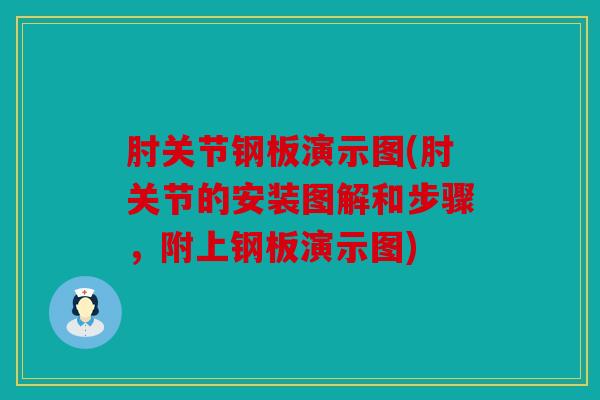 肘关节钢板演示图(肘关节的安装图解和步骤,附上钢板演示图) 肘关节钢板演示图(肘关节的安装图解和步骤,附上钢板演示图)