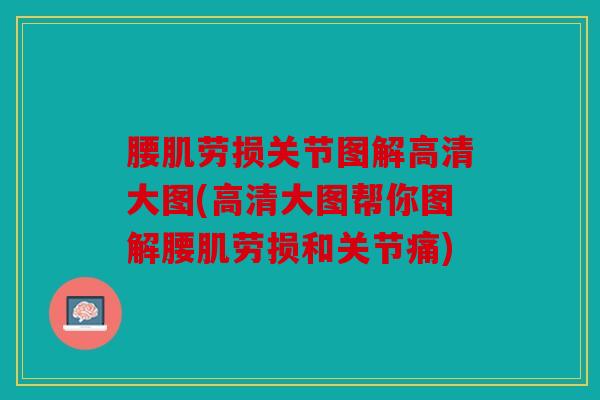腰肌劳损关节图解高清大图(高清大图帮你图解腰肌劳损和关节痛)