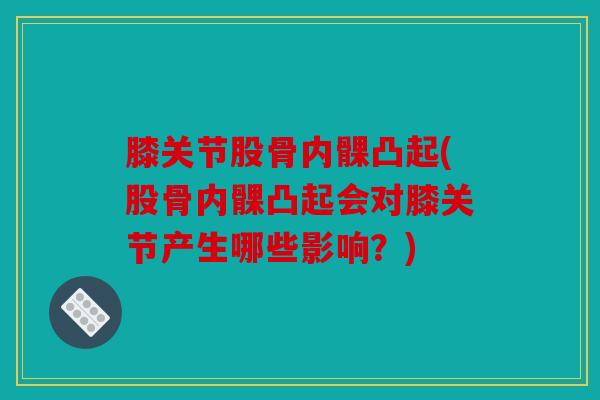 膝关节股骨内髁凸起(股骨内髁凸起会对膝关节产生哪些影响?) 膝关节股骨内髁凸起(股骨内髁凸起会对膝关节产生哪些影响?)
