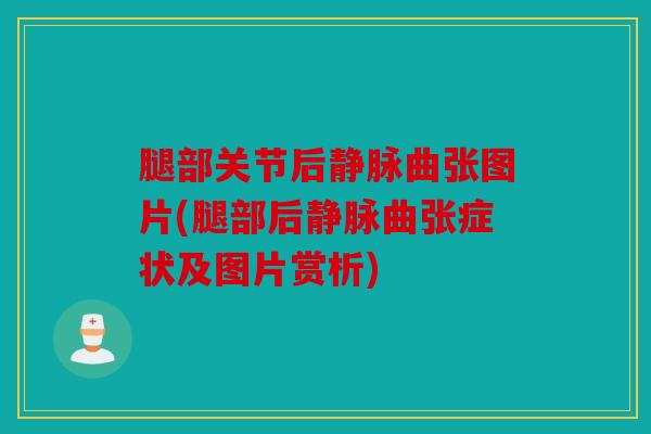 腿部关节后静脉曲张图片(腿部后静脉曲张症状及图片赏析) 腿部关节后静脉曲张图片(腿部后静脉曲张症状及图片赏析)