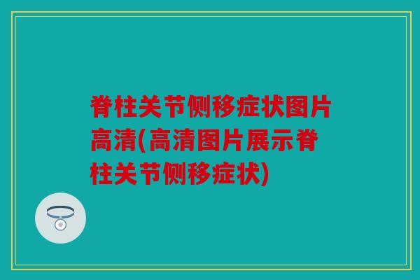 脊柱关节侧移症状图片高清(高清图片展示脊柱关节侧移症状) 脊柱关节侧移症状图片高清(高清图片展示脊柱关节侧移症状)