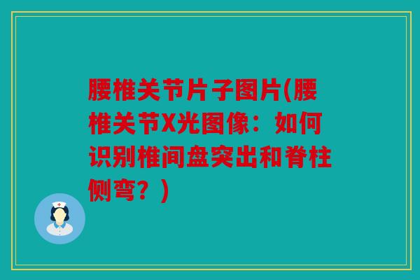 腰椎关节片子图片(腰椎关节X光图像:如何识别椎间盘突出和脊柱侧弯?) 腰椎关节片子图片(腰椎关节X光图像:如何识别椎间盘突出和脊柱侧弯?)