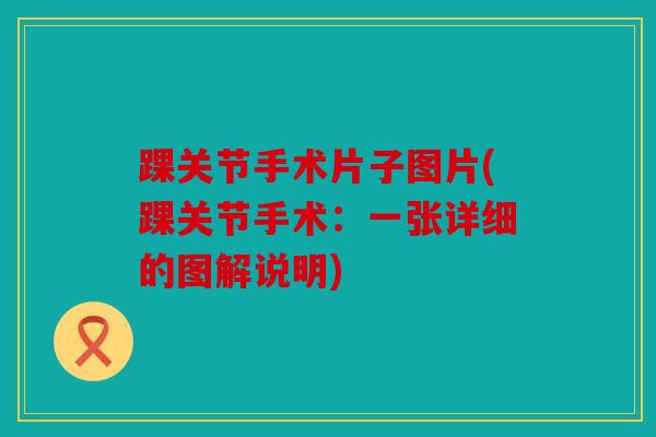 踝关节手术片子图片(踝关节手术:一张详细的图解说明) 踝关节手术片子图片(踝关节手术:一张详细的图解说明)