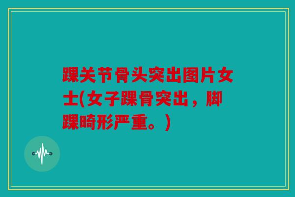踝关节骨头突出图片女士(女子踝骨突出，脚踝畸形严重。)