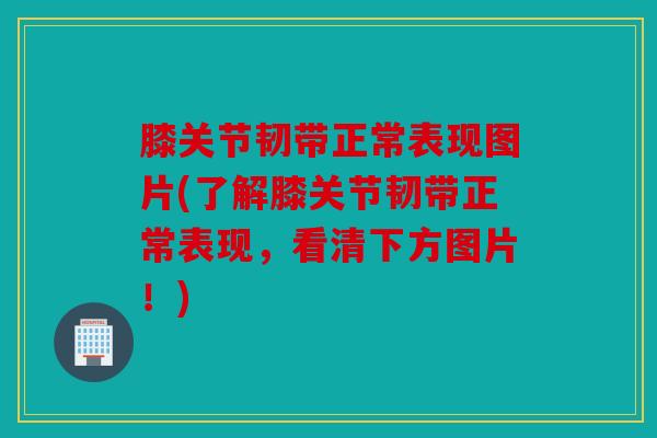 膝关节韧带正常表现图片(了解膝关节韧带正常表现,看清下方图片!) 膝关节韧带正常表现图片(了解膝关节韧带正常表现,看清下方图片!)